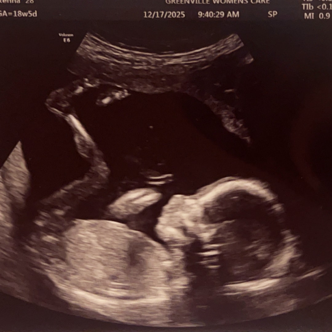 Photo shared by Kenna for their Babylist baby registry.