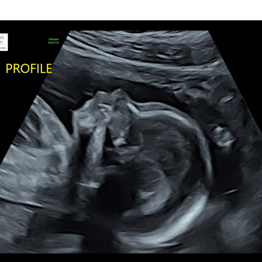 Photo shared by Mia for their Babylist baby registry.