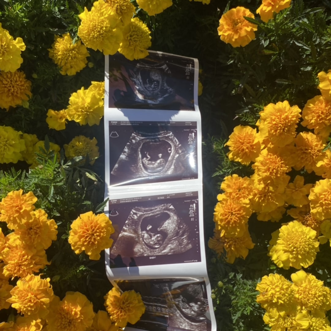 Photo shared by Shi for their Babylist baby registry.