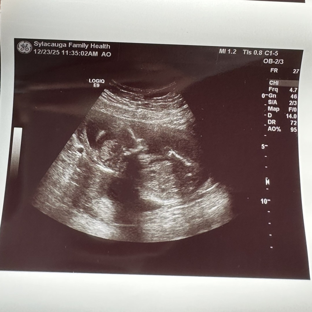 Photo shared by Breanna for their Babylist baby registry.