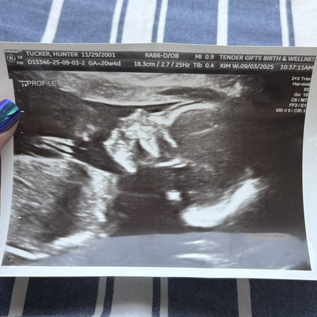 Photo shared by Hunter for their Babylist baby registry.