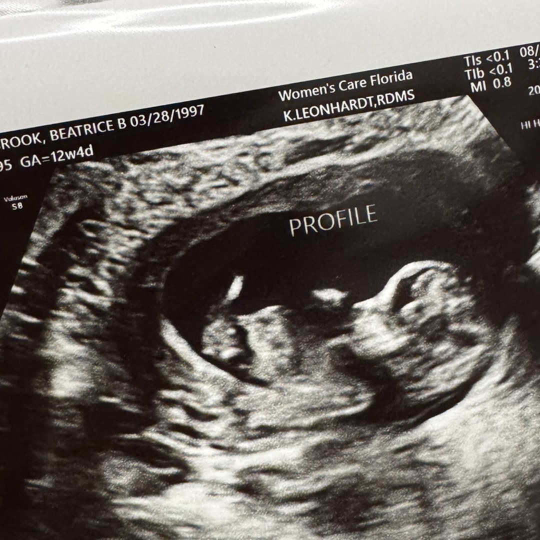 Photo shared by Beatrice for their Babylist baby registry.