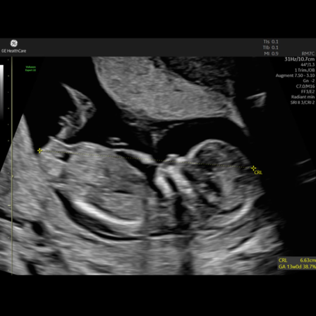 Photo shared by Jaida for their Babylist baby registry.