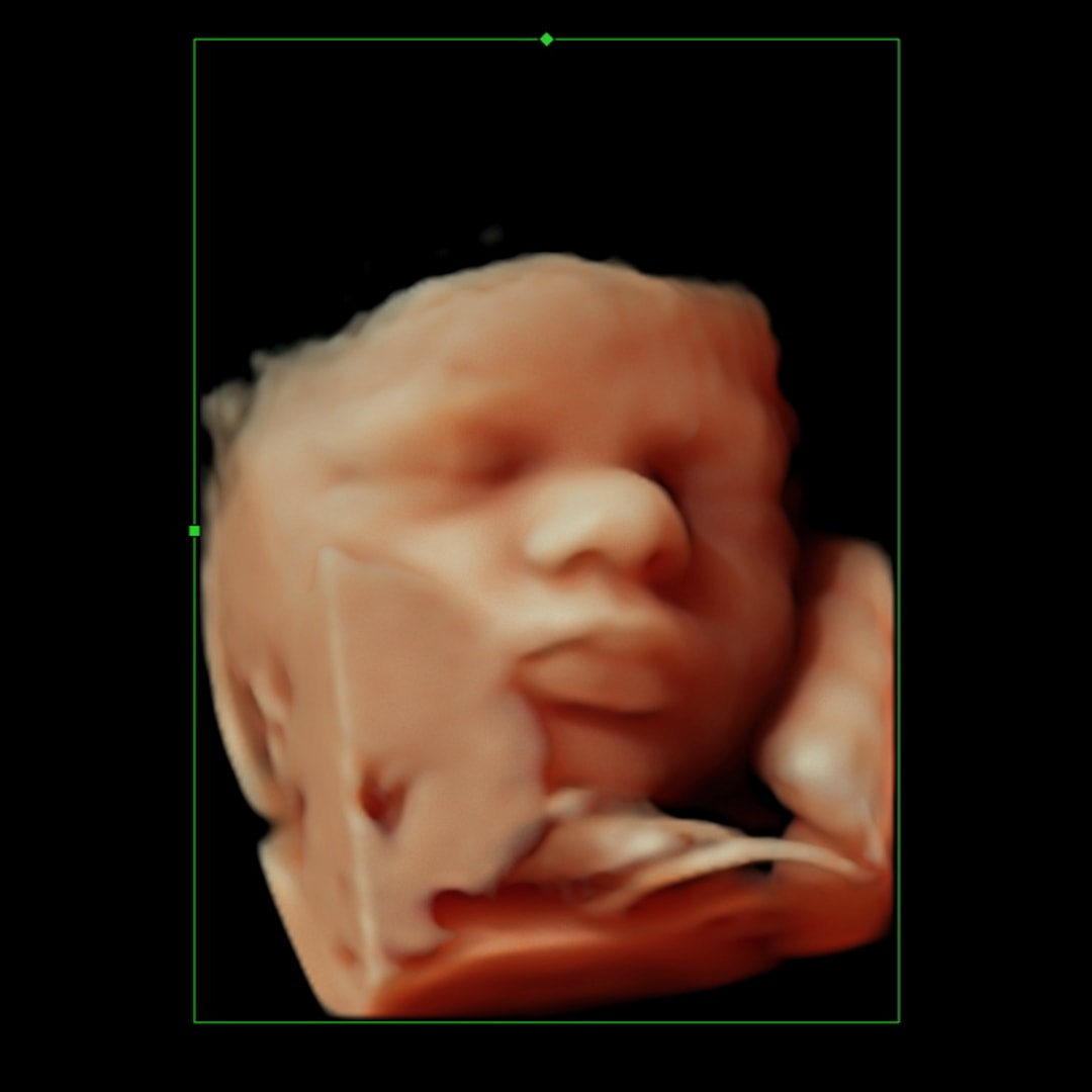 Photo shared by Ellyce for their Babylist baby registry.