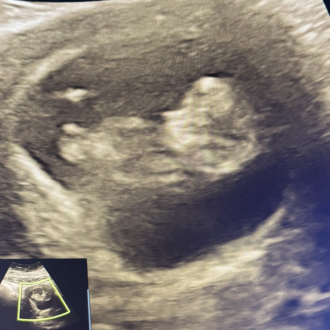 Photo shared by Constance for their Babylist baby registry.