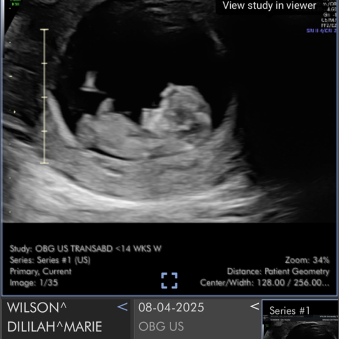 Photo shared by Dililah for their Babylist baby registry.