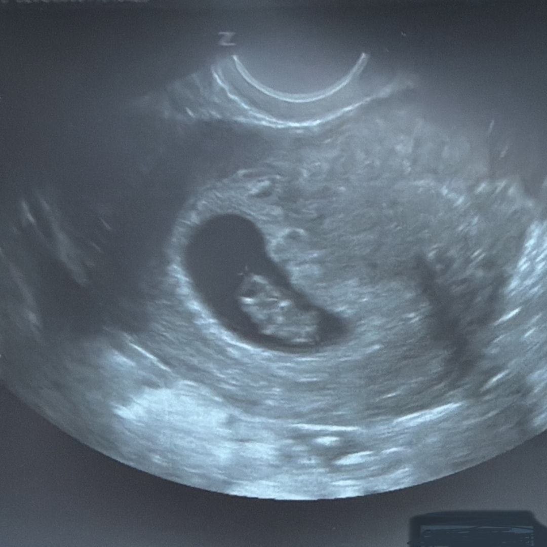 Photo shared by Leticia for their Babylist baby registry.