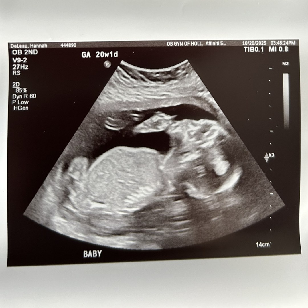 Photo shared by Hannah for their Babylist baby registry.