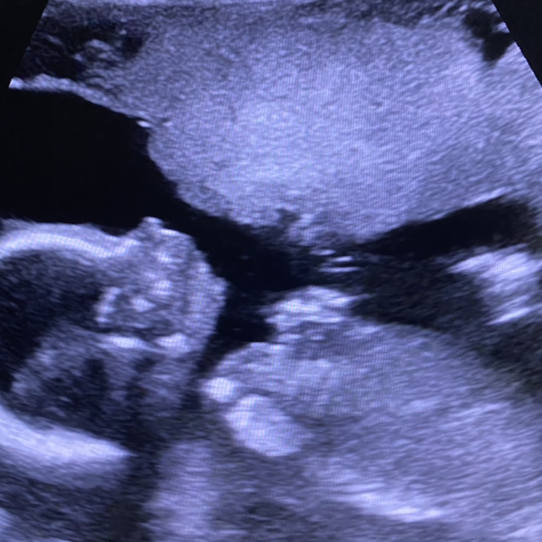 Photo shared by Lauren for their Babylist baby registry.