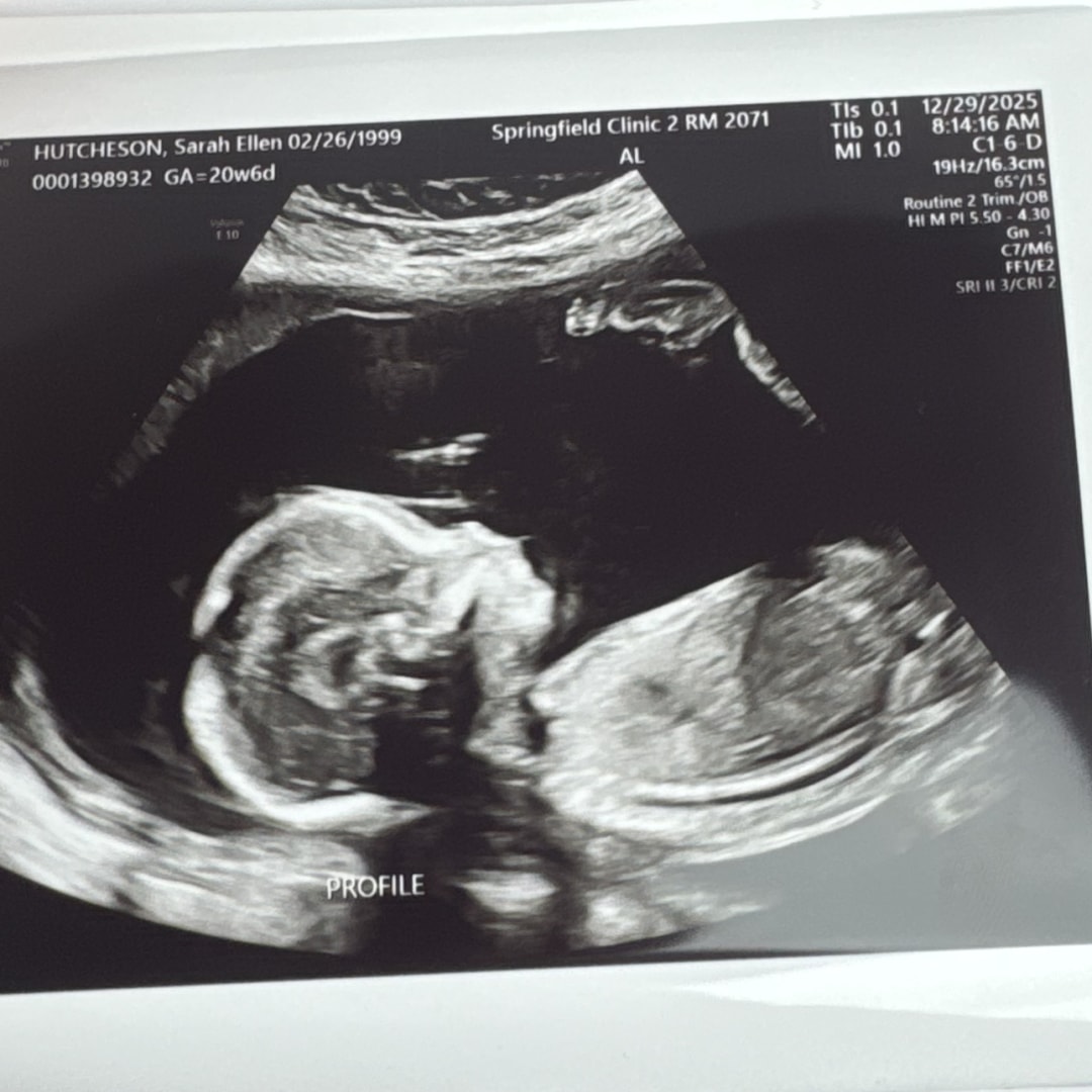 Photo shared by Sarah for their Babylist baby registry.