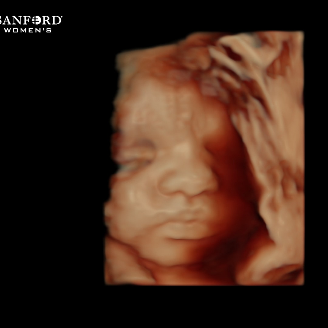 Photo shared by Rachel for their Babylist baby registry.