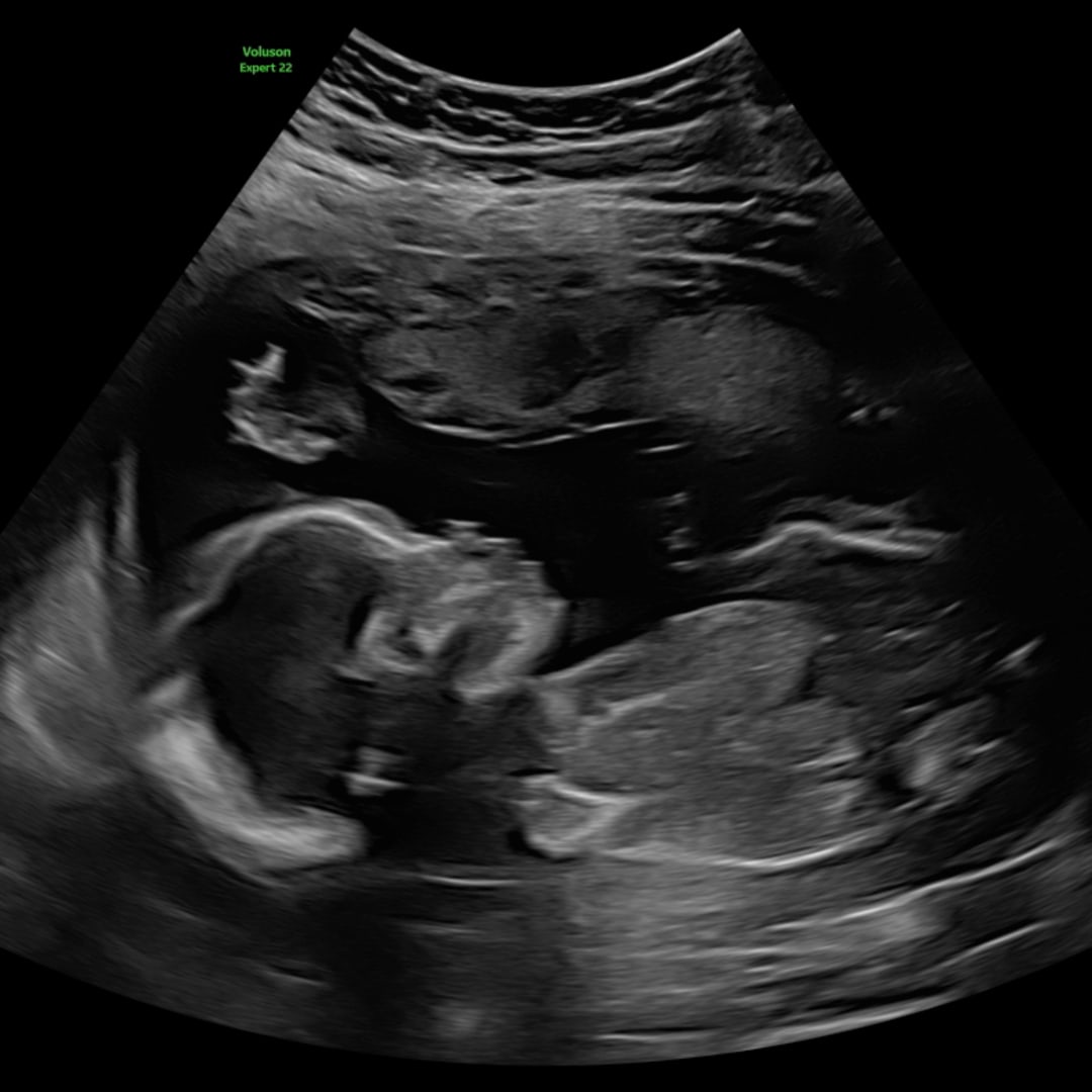 Photo shared by Aaquilah for their Babylist baby registry.