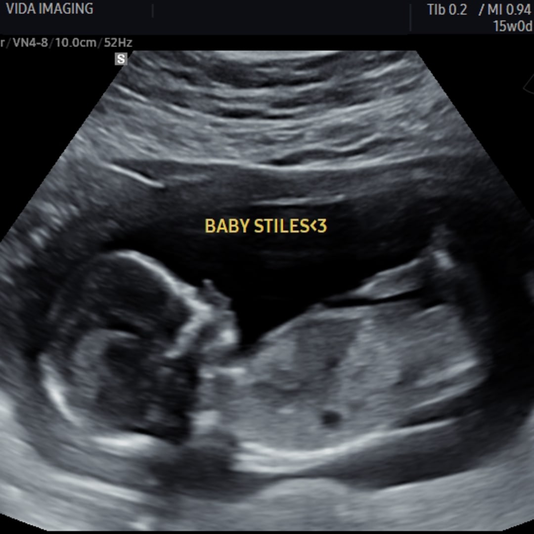 Photo shared by Gabby for their Babylist baby registry.