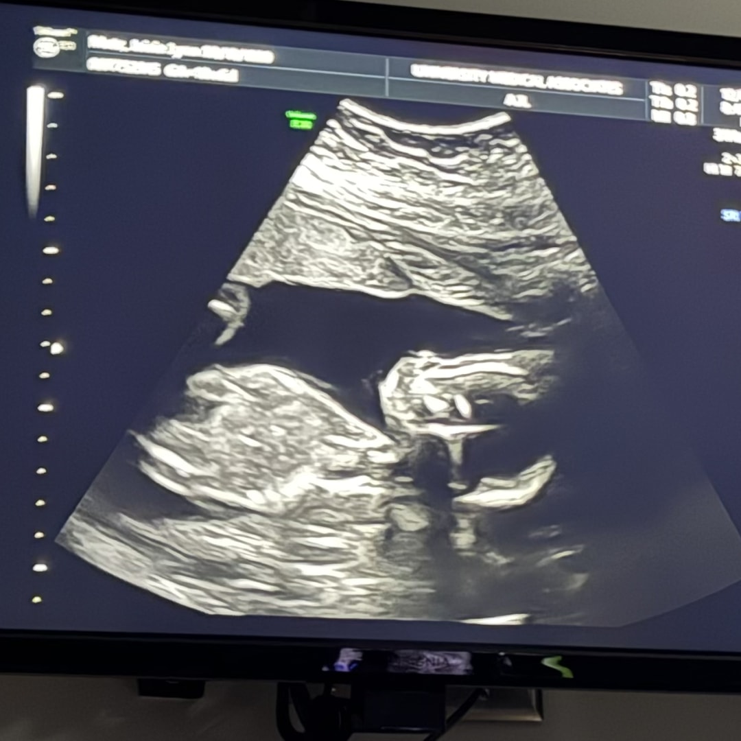 Photo shared by Jaicie for their Babylist baby registry.