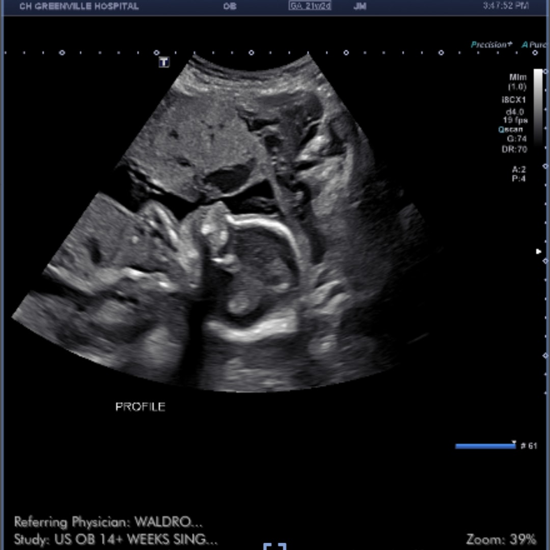 Photo shared by Leandra for their Babylist baby registry.