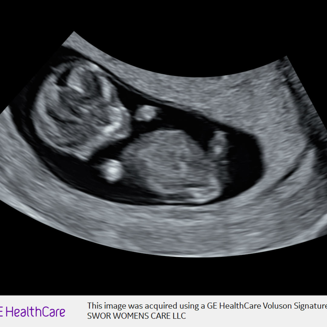 Photo shared by Kaleigh for their Babylist baby registry.