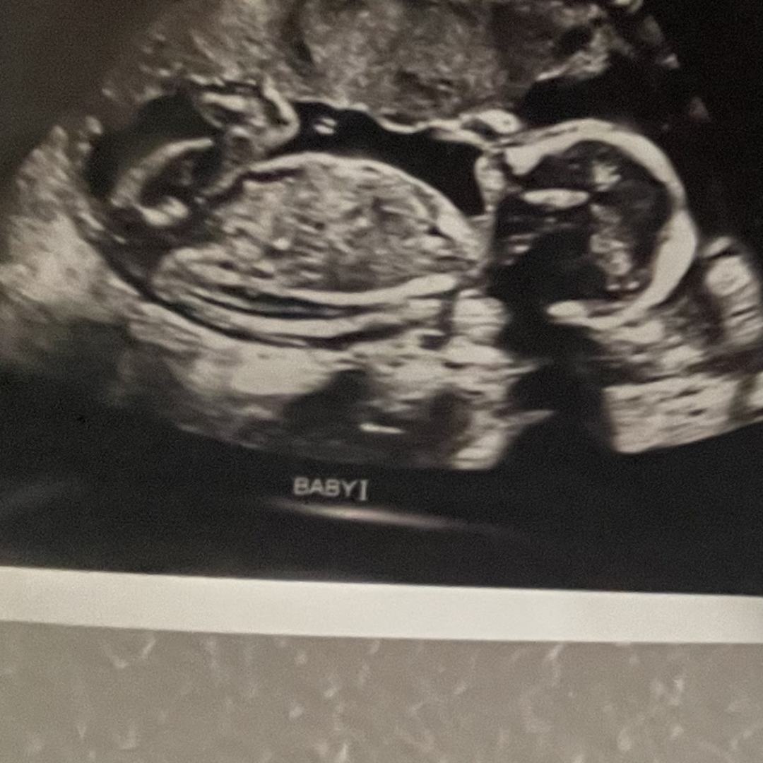 Photo shared by Fayth for their Babylist baby registry.