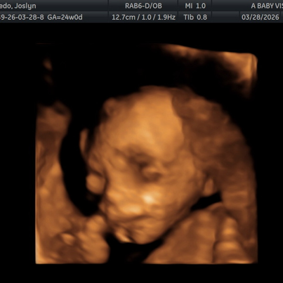 Photo shared by Joslyn for their Babylist baby registry.