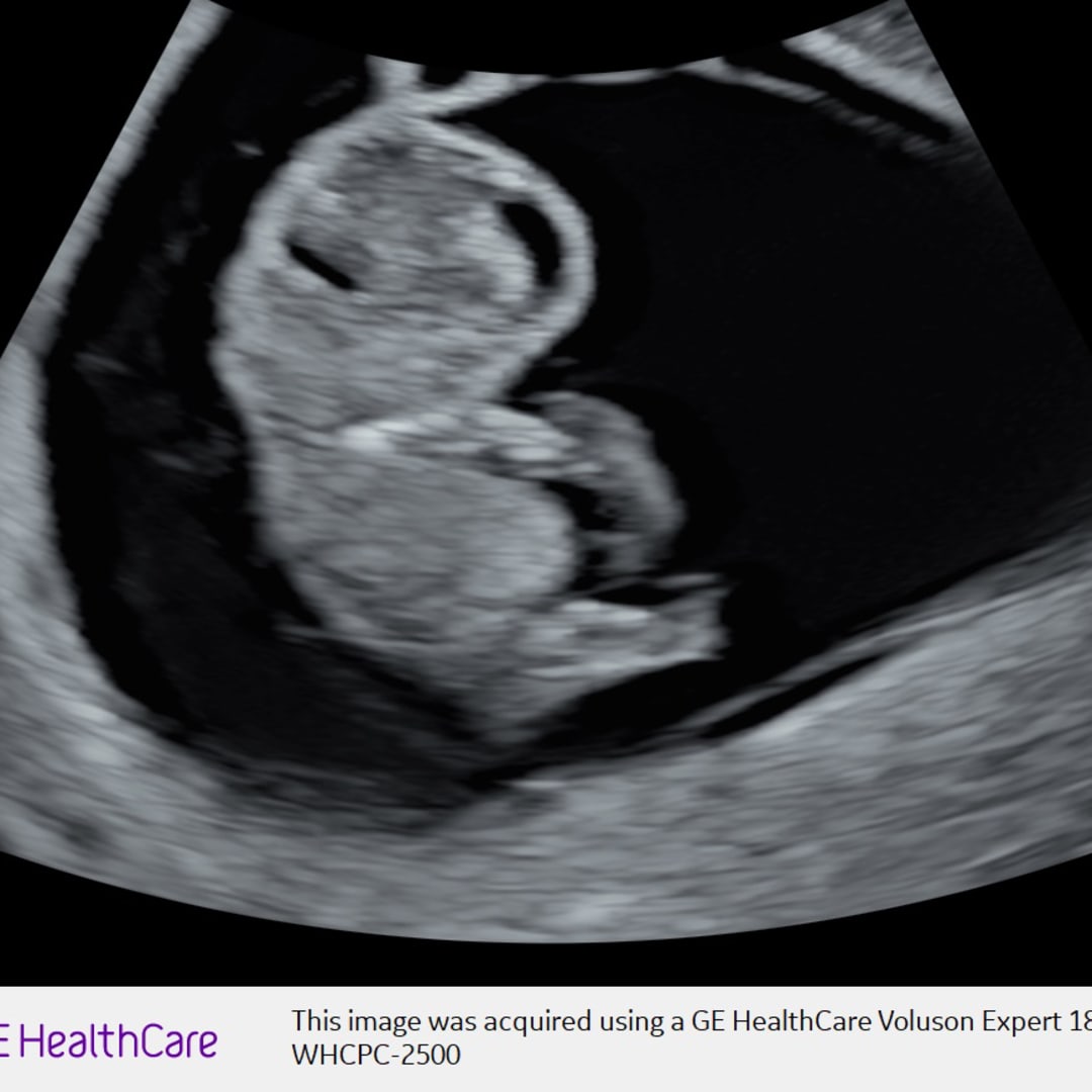 Photo shared by Briley for their Babylist baby registry.