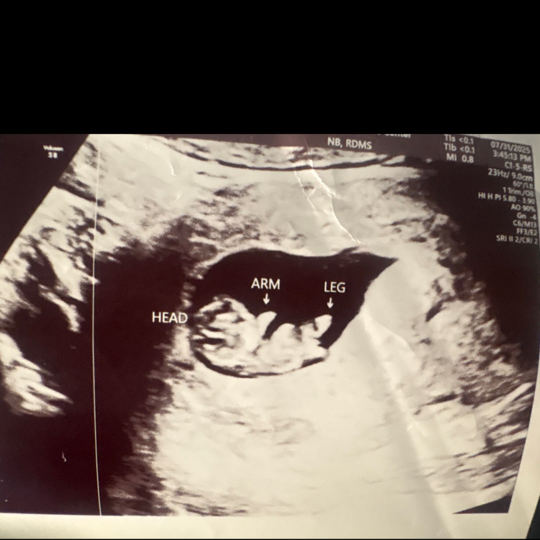 Photo shared by Zarriana for their Babylist baby registry.