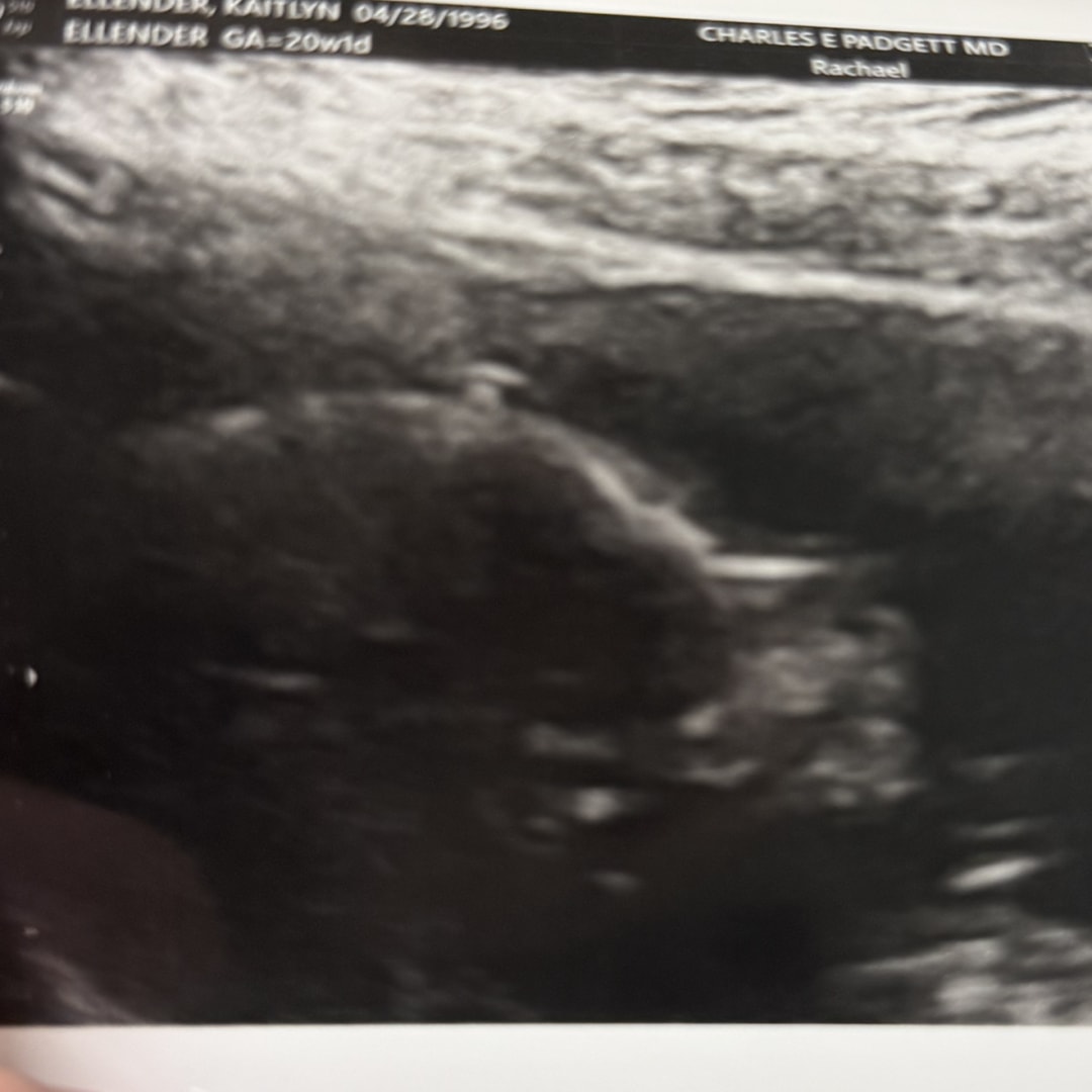 Photo shared by Kaitlyn for their Babylist baby registry.