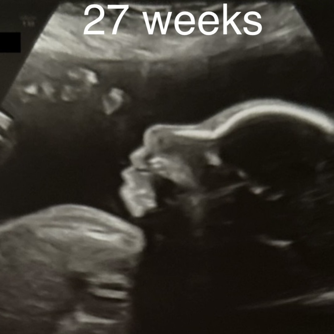 Photo shared by Erica for their Babylist baby registry.