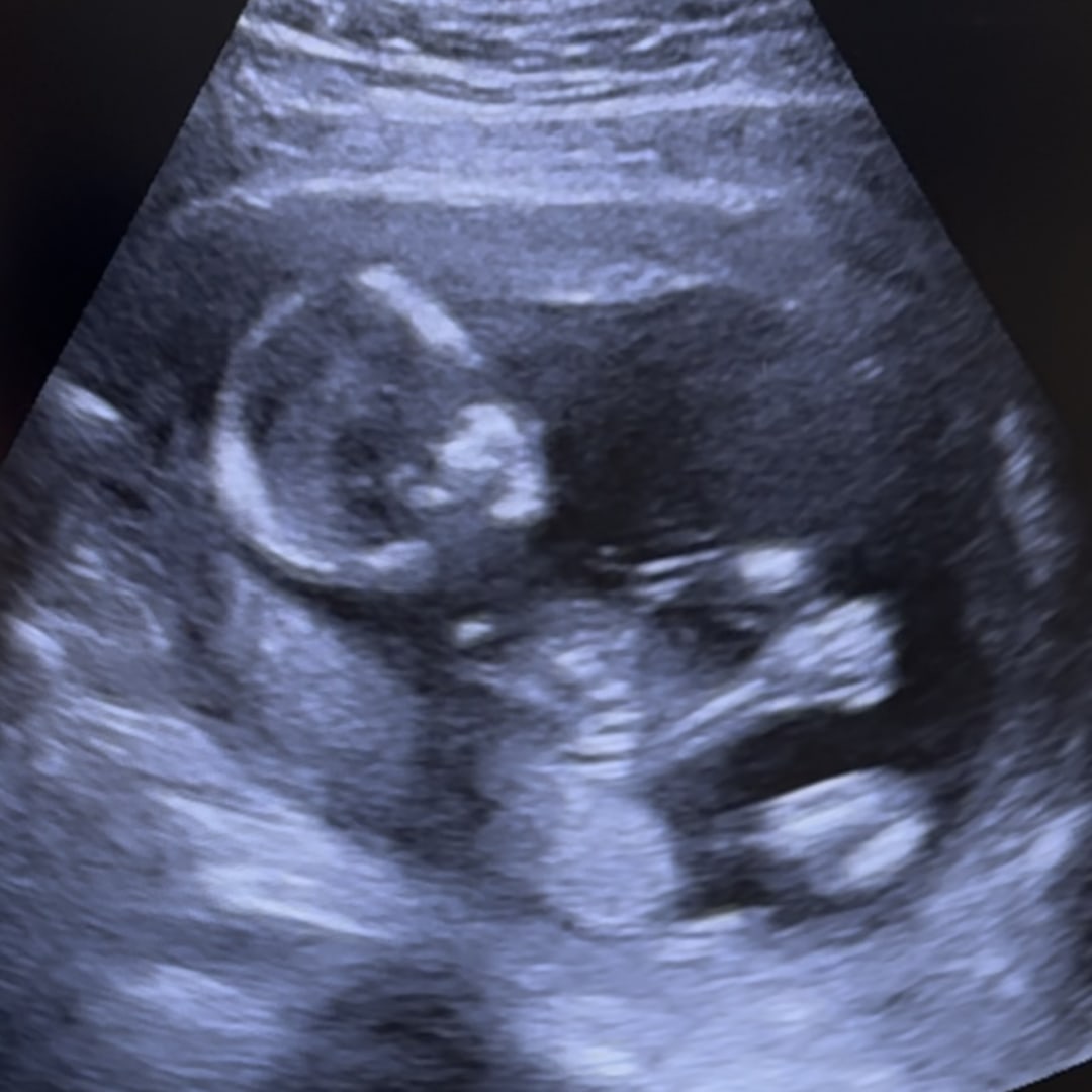 Photo shared by Nancy for their Babylist baby registry.