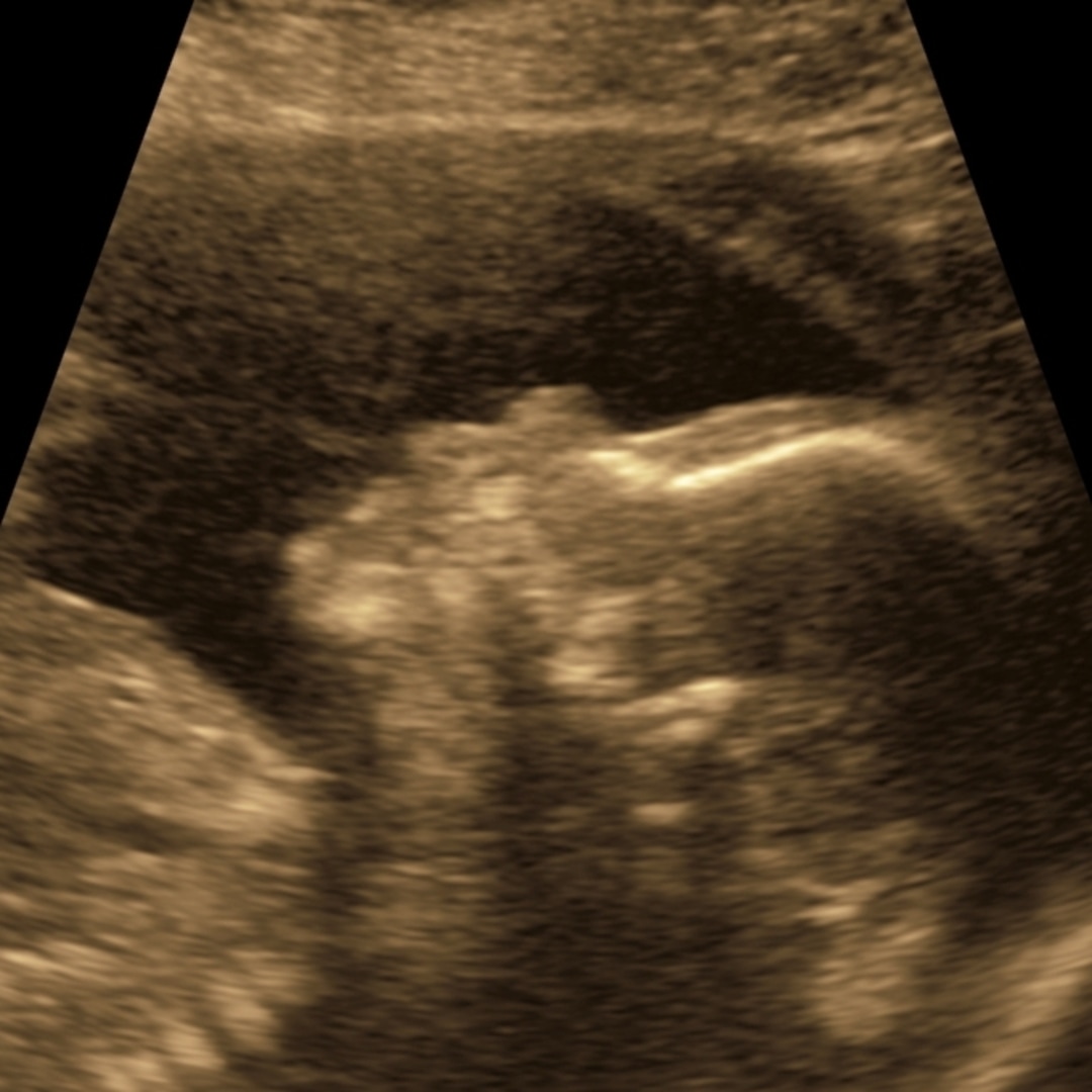 Photo shared by Elizabeth for their Babylist baby registry.
