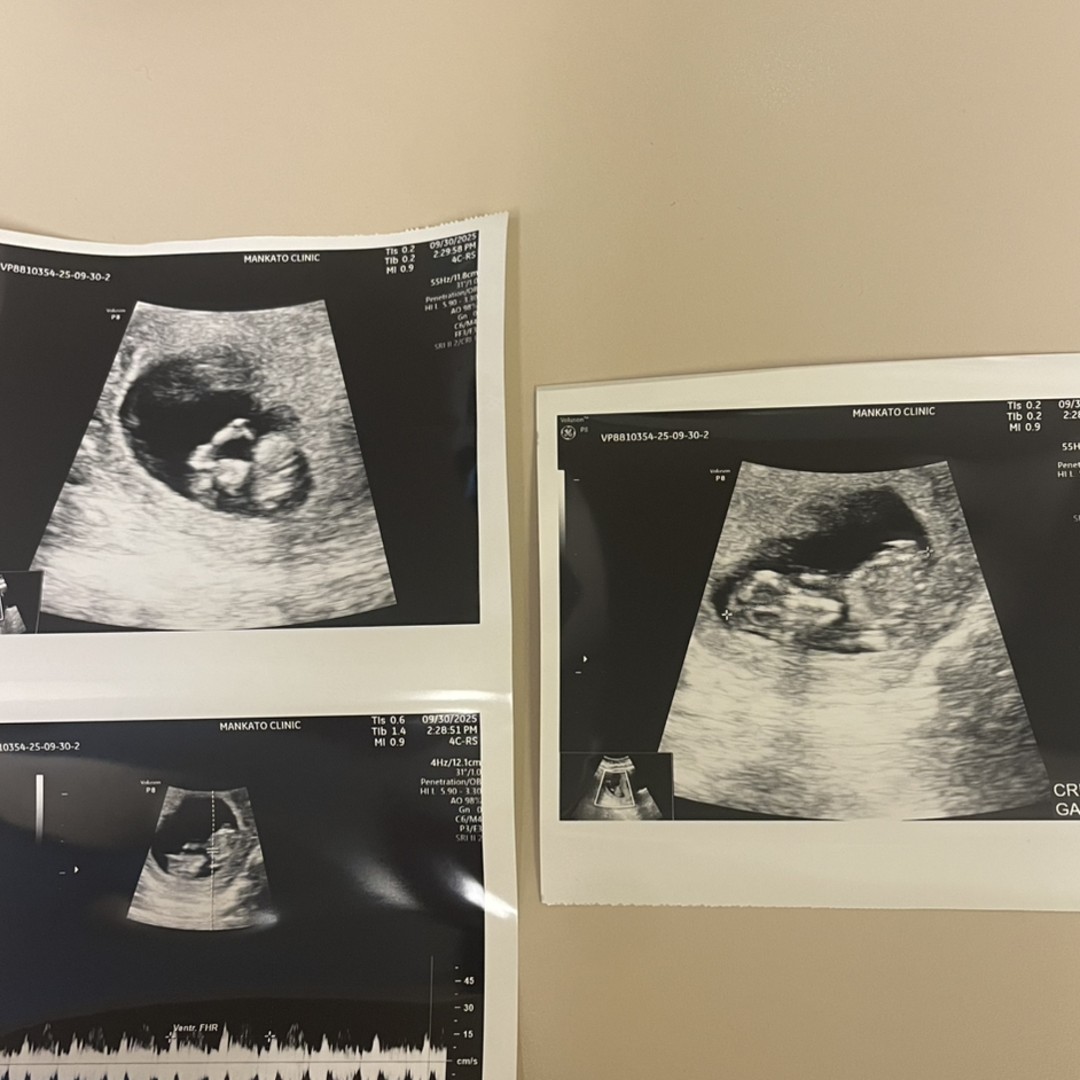 Photo shared by Kati for their Babylist baby registry.