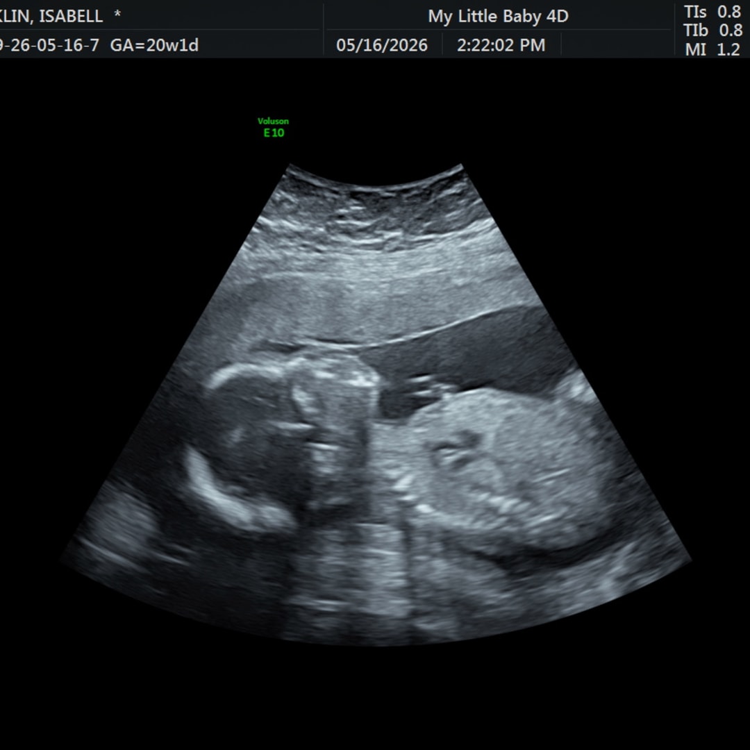 Photo shared by Isabell for their Babylist baby registry.