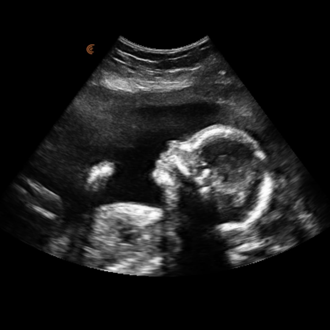 Photo shared by Ally for their Babylist baby registry.