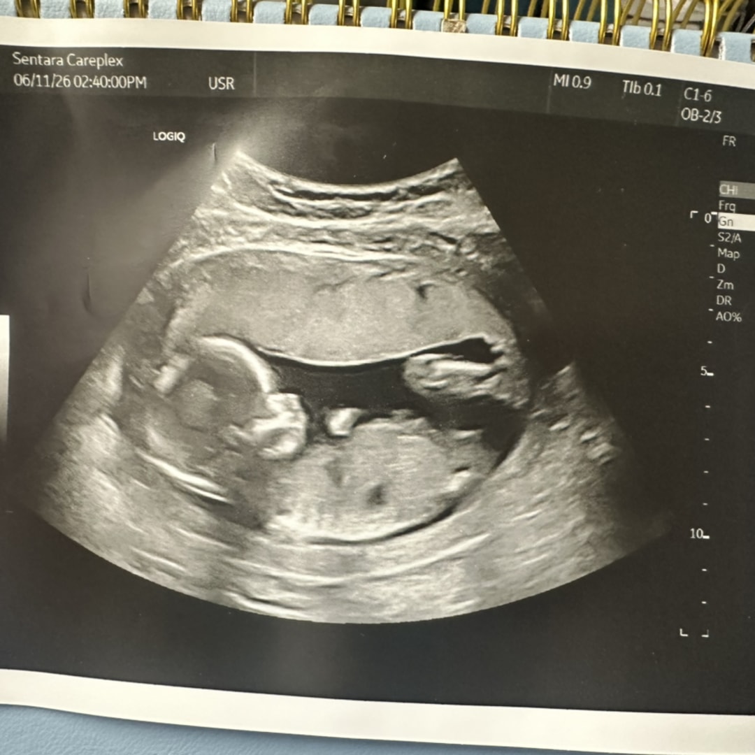 Photo shared by Joehauna for their Babylist baby registry.