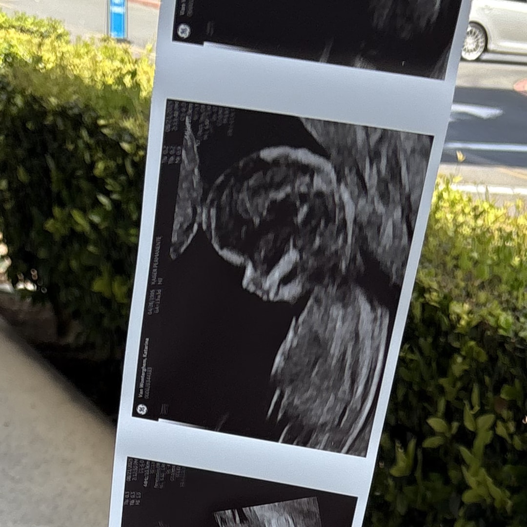 Photo shared by Katie for their Babylist baby registry.