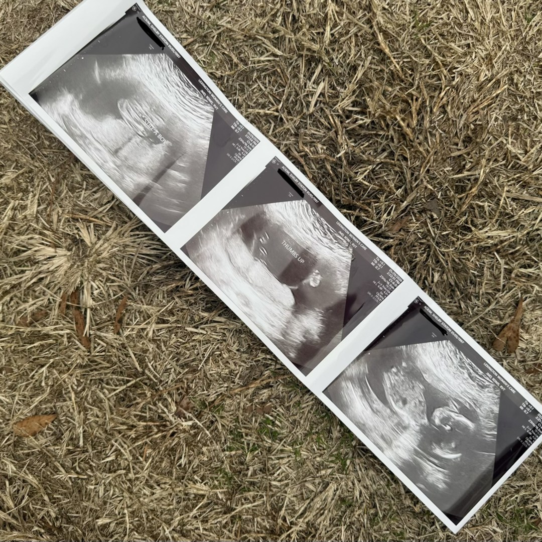 Photo shared by Shelby for their Babylist baby registry.