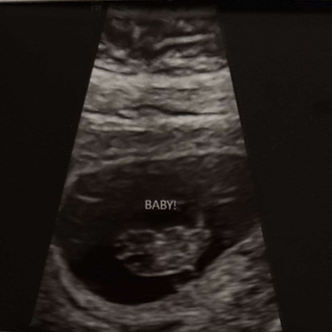 Photo shared by Cecilia for their Babylist baby registry.