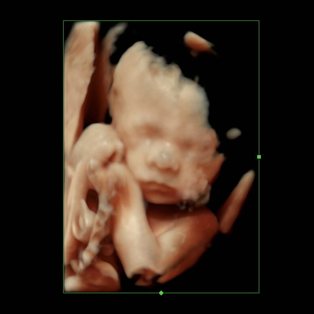 Photo shared by Lindsay for their Babylist baby registry.