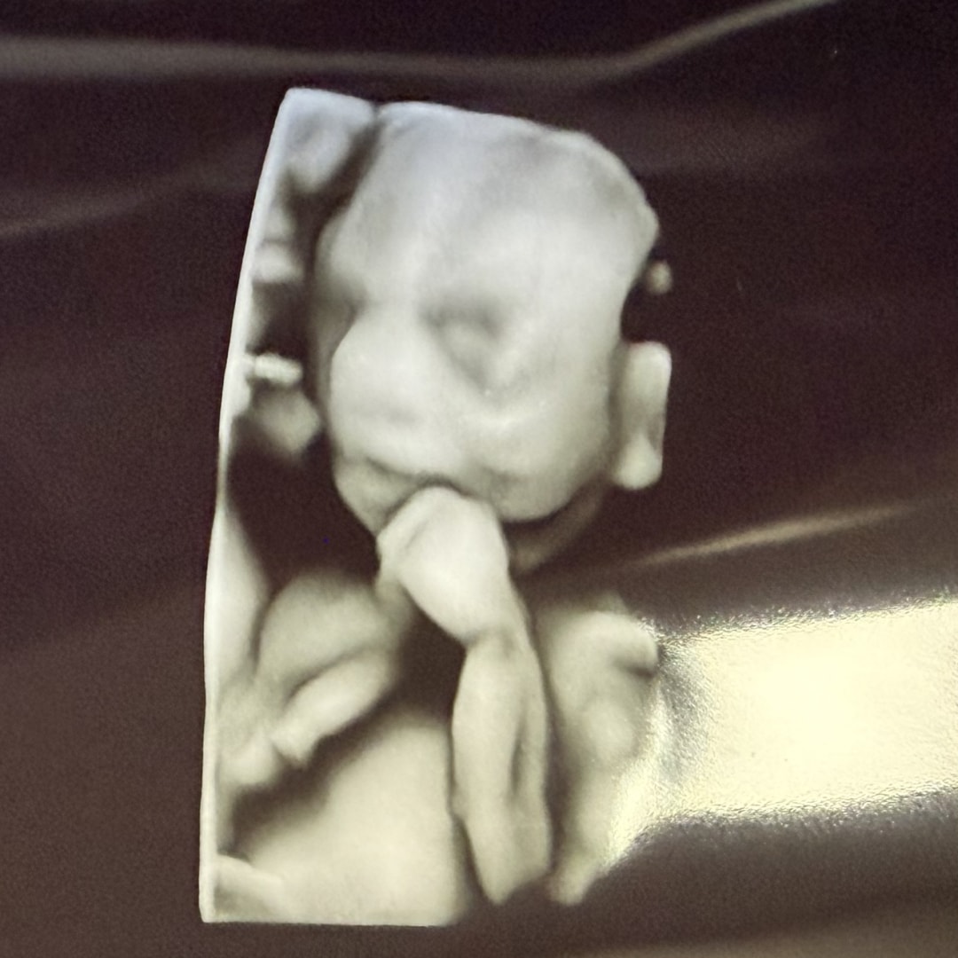 Photo shared by Aubrea for their Babylist baby registry.