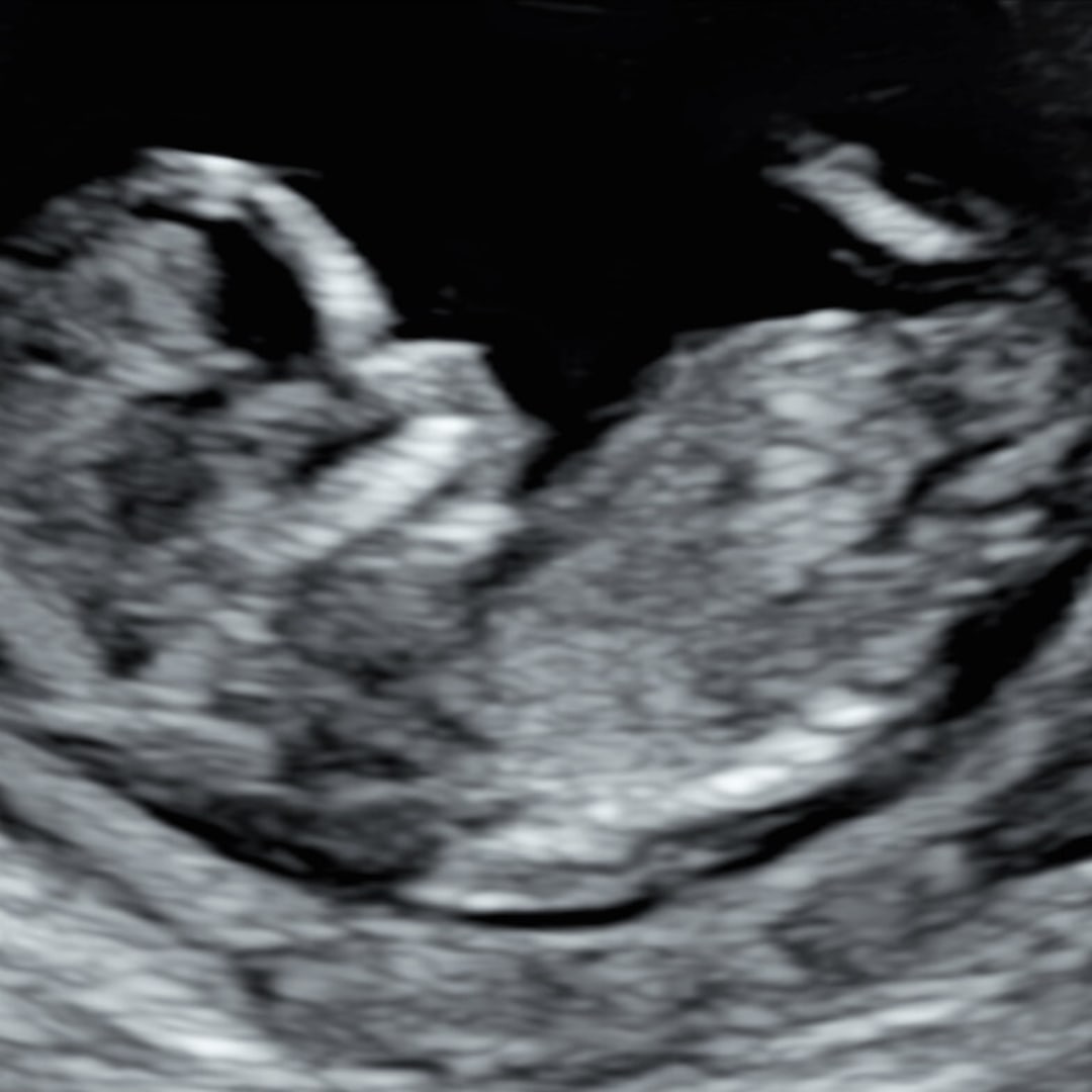 Photo shared by Hannah for their Babylist baby registry.