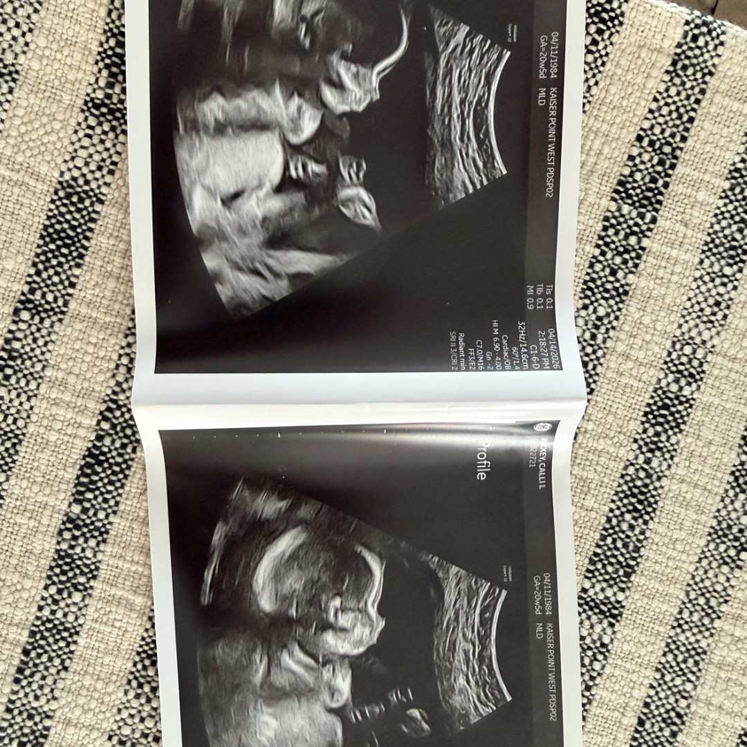 Photo shared by Calli for their Babylist baby registry.