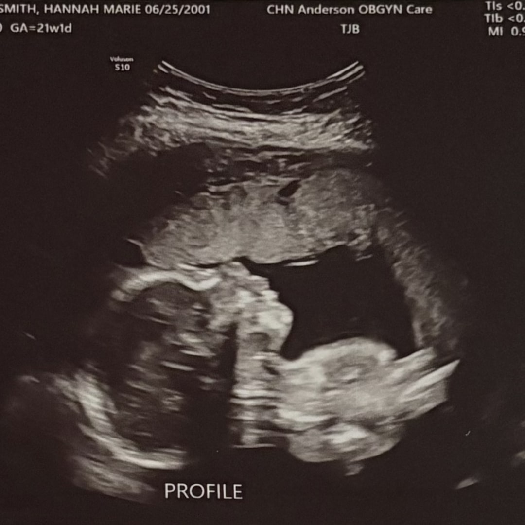 Photo shared by Hannah for their Babylist baby registry.