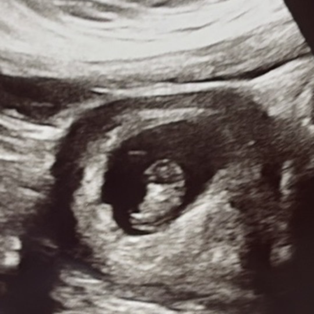 Photo shared by Lauren for their Babylist baby registry.