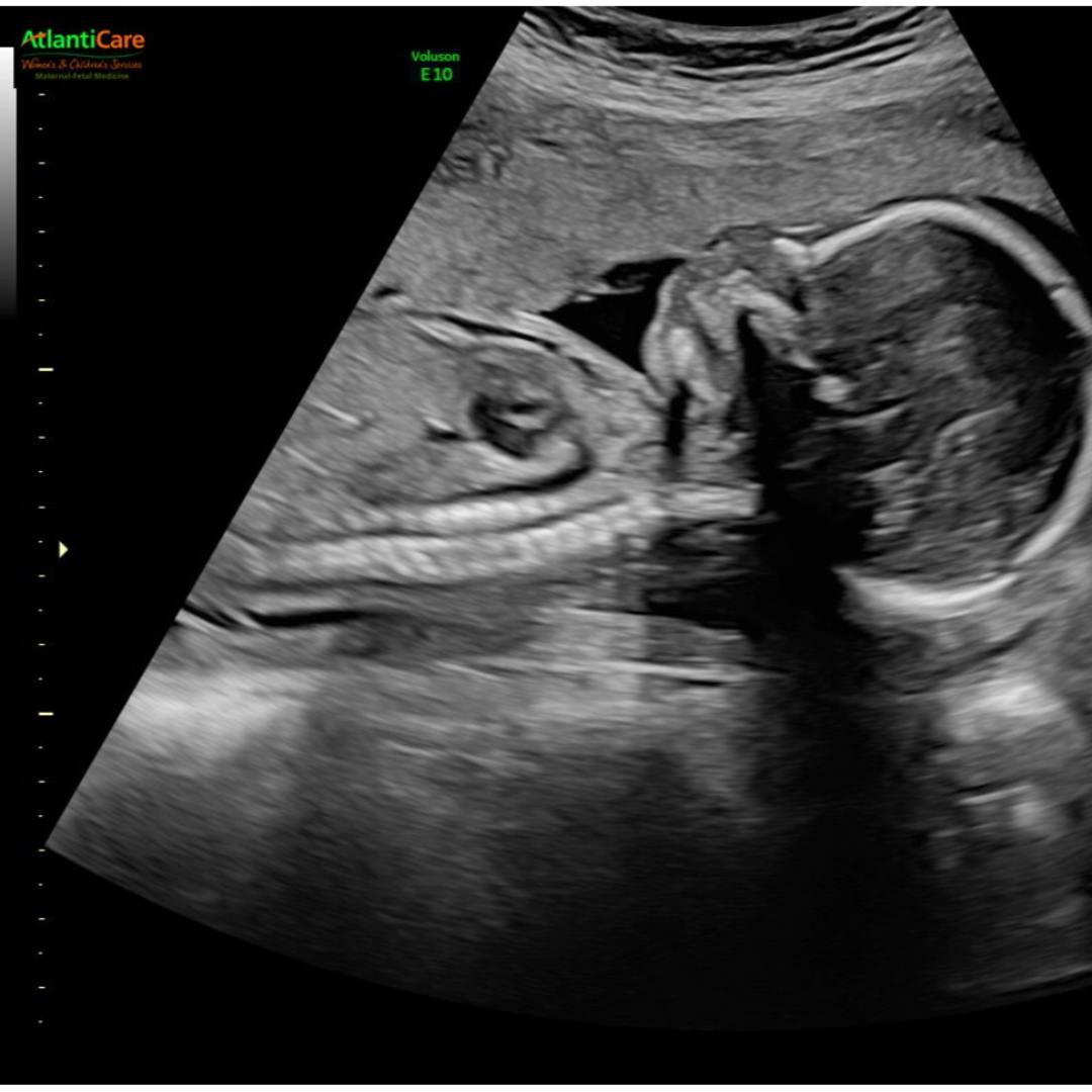 Photo shared by Alicia for their Babylist baby registry.