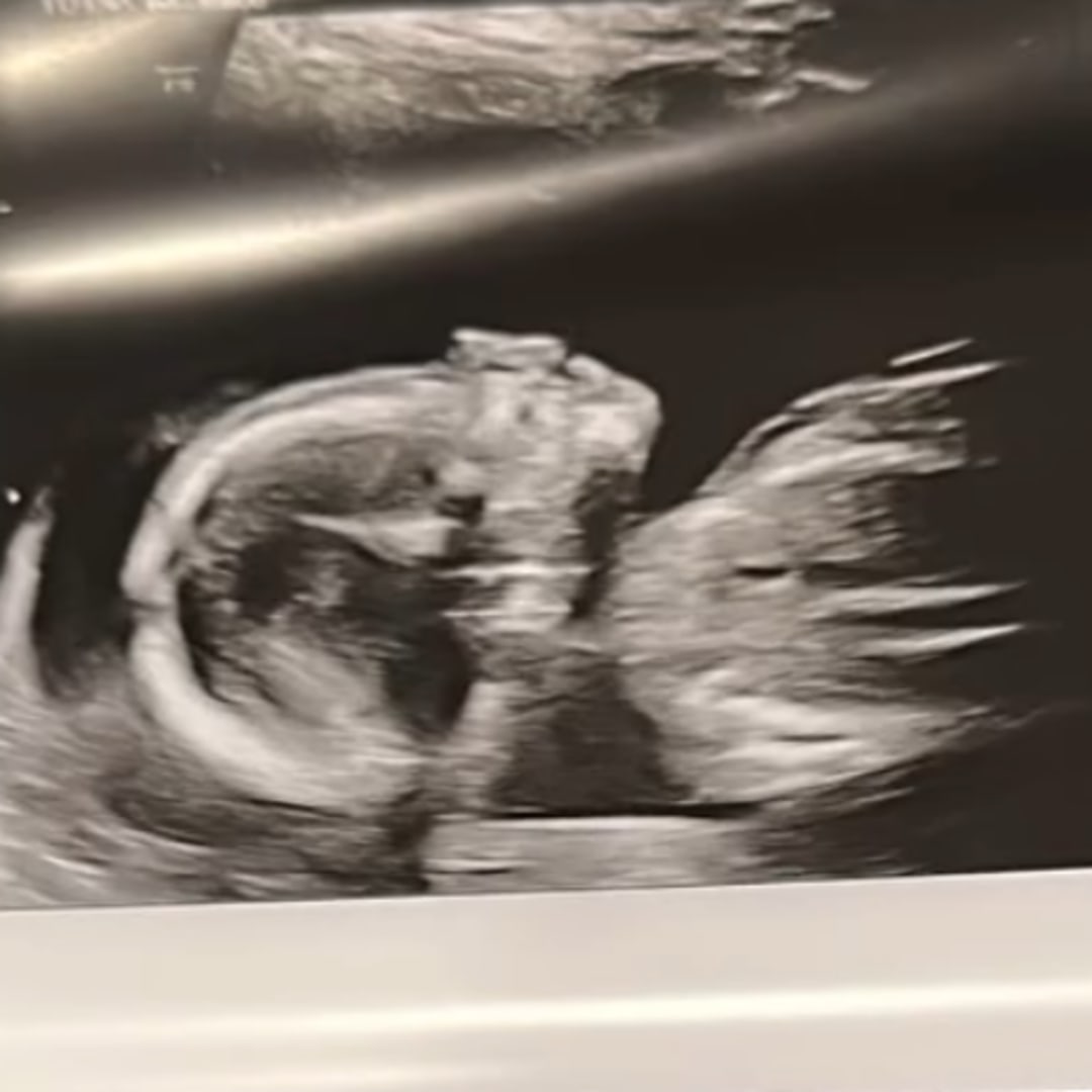 Photo shared by Hailey for their Babylist baby registry.