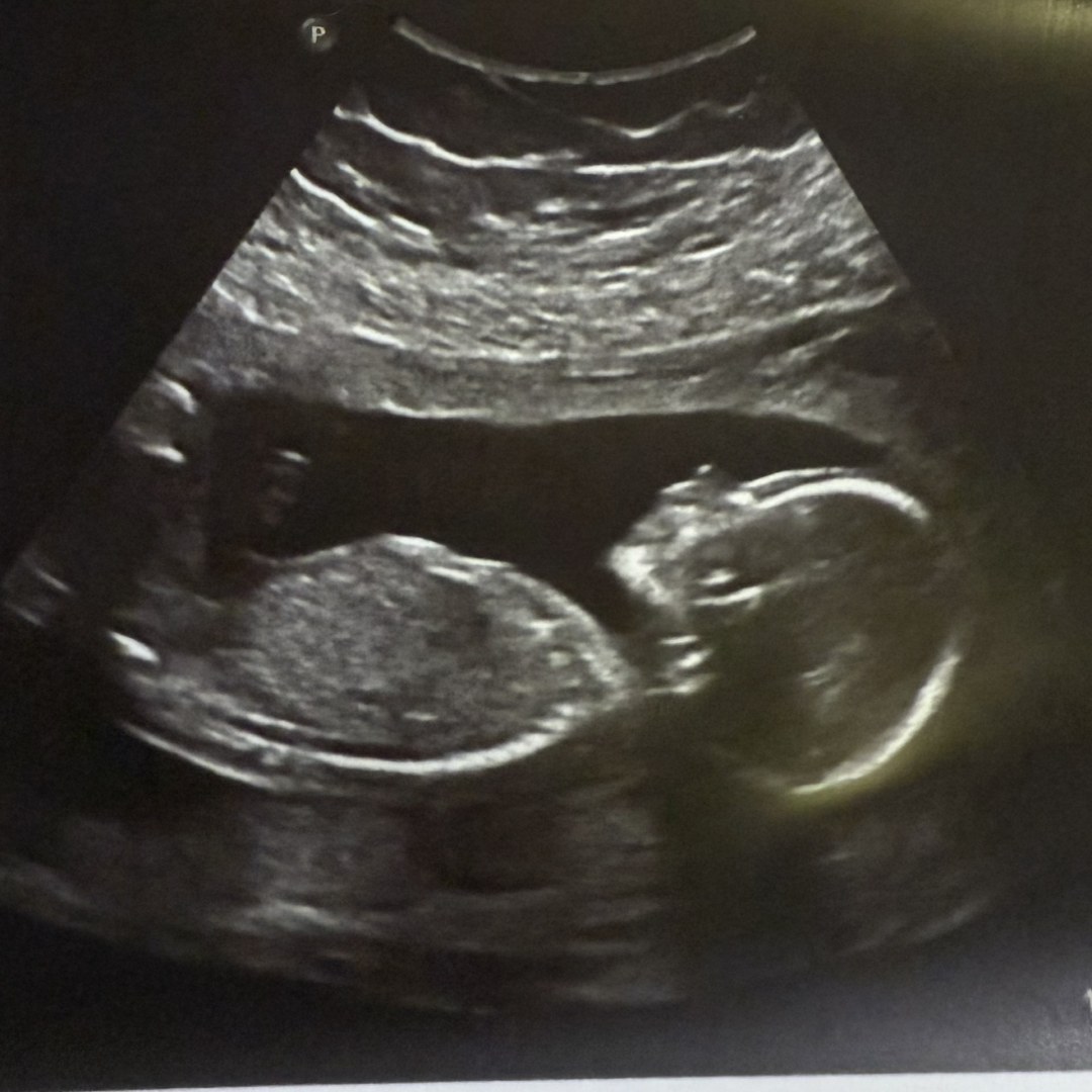 Photo shared by Anabel for their Babylist baby registry.