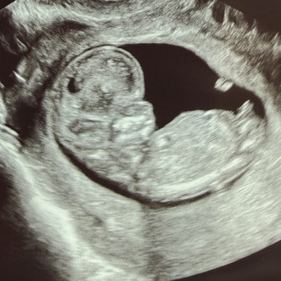 Photo shared by Avery for their Babylist baby registry.