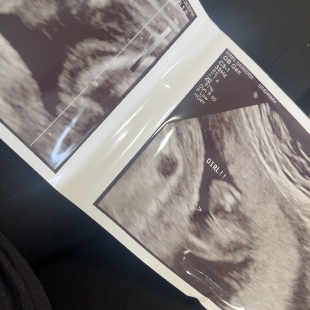 Photo shared by Dawndria for their Babylist baby registry.