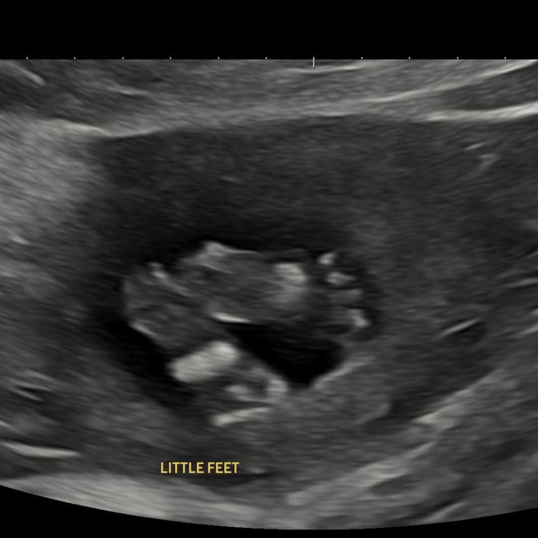 Photo shared by Crystal for their Babylist baby registry.