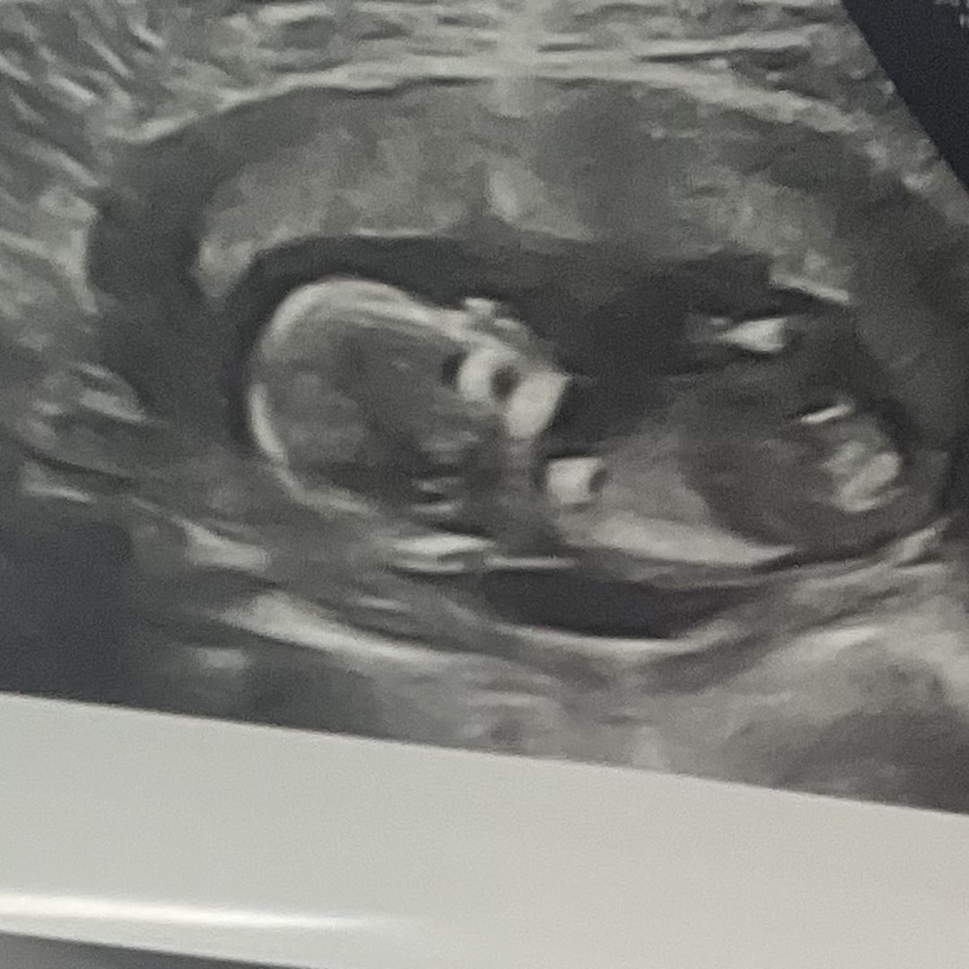 Photo shared by Drew for their Babylist baby registry.