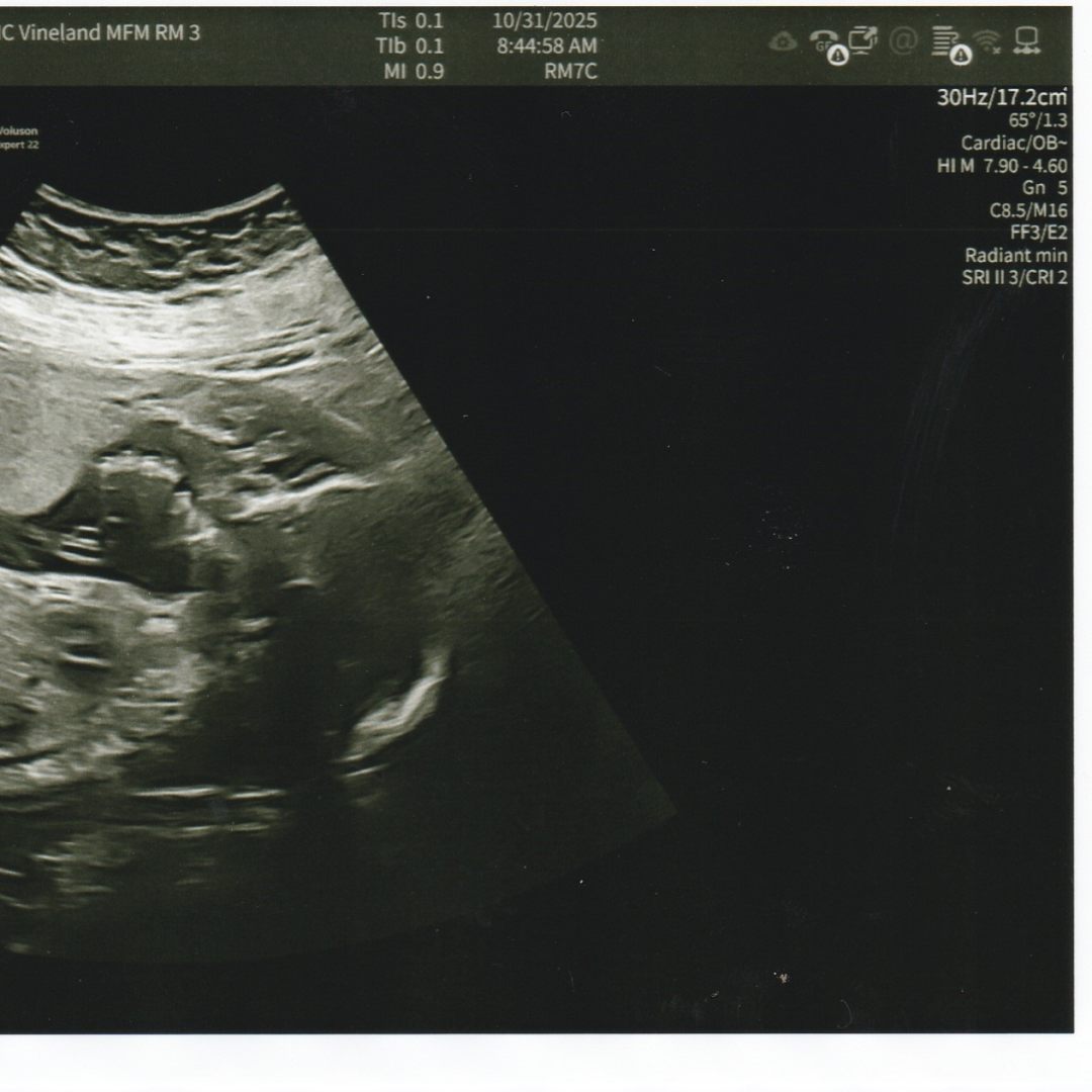 Photo shared by Roxanne for their Babylist baby registry.