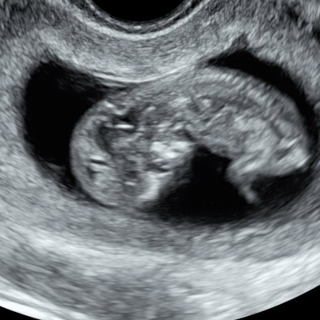 Photo shared by Kiara for their Babylist baby registry.
